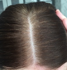 Let my natural colour come through? Pics
