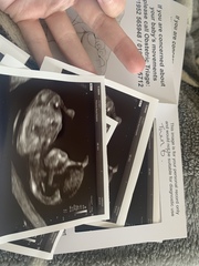 Pregnant with twins!