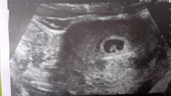Ramzi theory anyone? 7 weeks scan