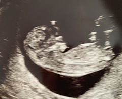 Boy or girl!! ❣️ Any guesses?