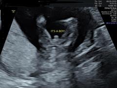 Boy or girl? Help!!