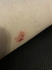 What on EARTH are these patches all over my body..?