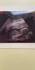 Boy or girl👶🏻