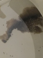 To ask you if there's a parasite living in our loo (gross photos included)