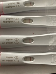 Should I be worried it’s staying the same?