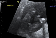 Gender scan photos, what do you think!