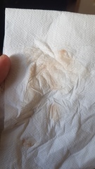 Implantation bleed? Tmi pic! Sorry if it's a long one!