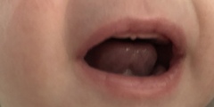 Is this really a tongue tie?
