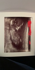 12+2 scan..anyone want to guess the sex?