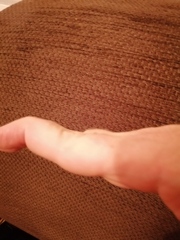 Is my thumb weird?