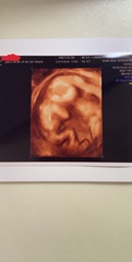 Boy or girl👶🏻