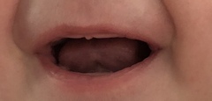 Is this really a tongue tie?