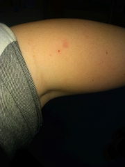 To ask what this Mark/spot looks like