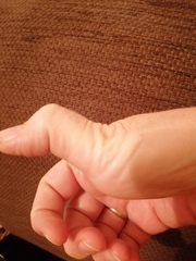 Is my thumb weird?