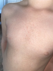 Is this an allergic reaction or something else? Dd4.