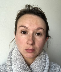 Help with skincare regime? Pics attached.