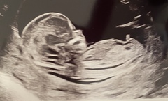 Gender guesses please