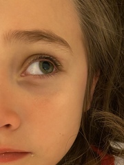 Small lump on DDs face... would you be concerned? Pics attached.