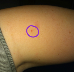 To ask what this Mark/spot looks like