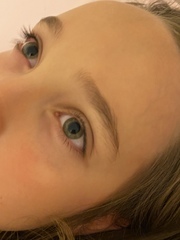 Small lump on DDs face... would you be concerned? Pics attached.