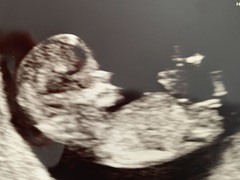 Boy or girl!! ❣️ Any guesses?