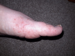 Help. What is this. rash on foot.