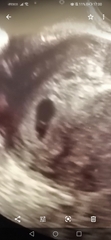 Early scan - What did you see?