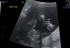 Gender scan photos, what do you think!