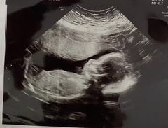 boy or girl guesses please? 20 weeks + 1 x