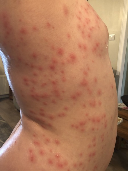 Dr won't examine rash