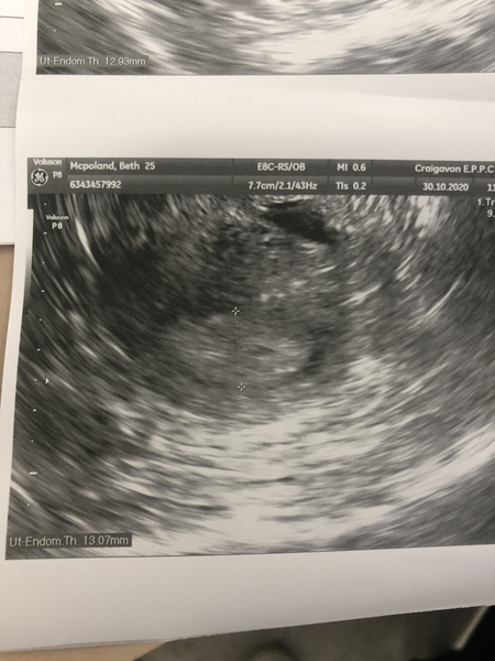 Early pregnancy