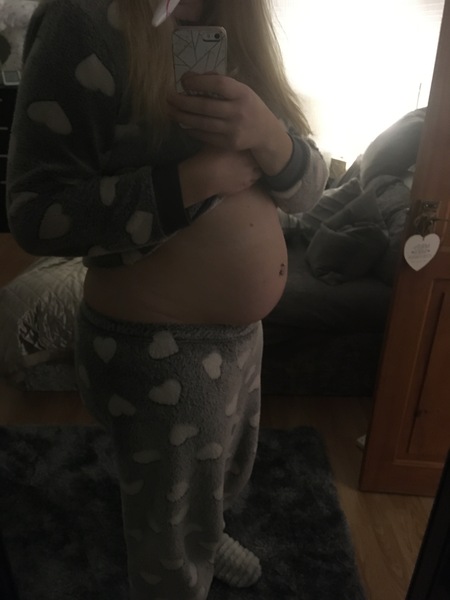 Pregnant After MMC - Thread 3