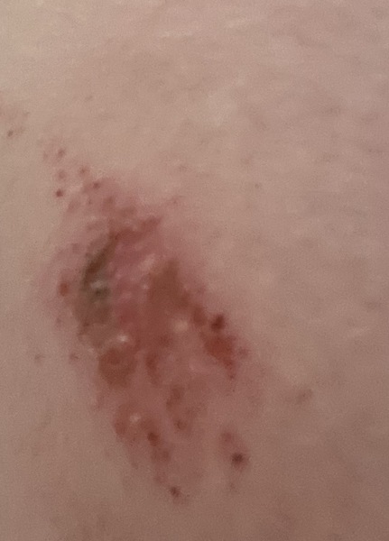 To ask if anyone knows why I could be getting these wounds?