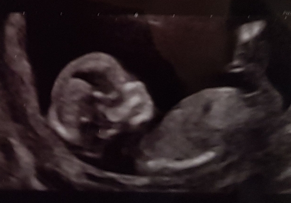Any guesses?