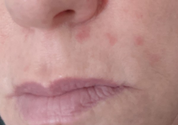 🐌 Fantastic Skincare: Jump through flaming hoops, repeat, 'Beauty is Pain', and acces to this thread will be unlocked