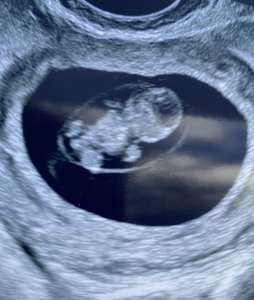 Is anyone else due on the 22nd may 2021?