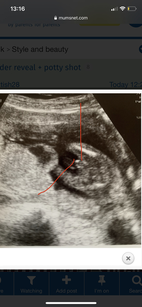 Gender reveal + potty shot