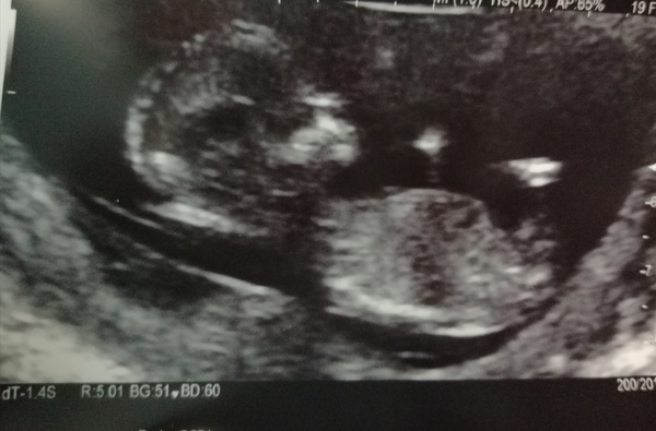 Gender Guesses Please ❤️💙