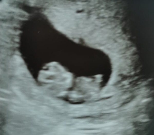 At Home Insemination - Buddies?