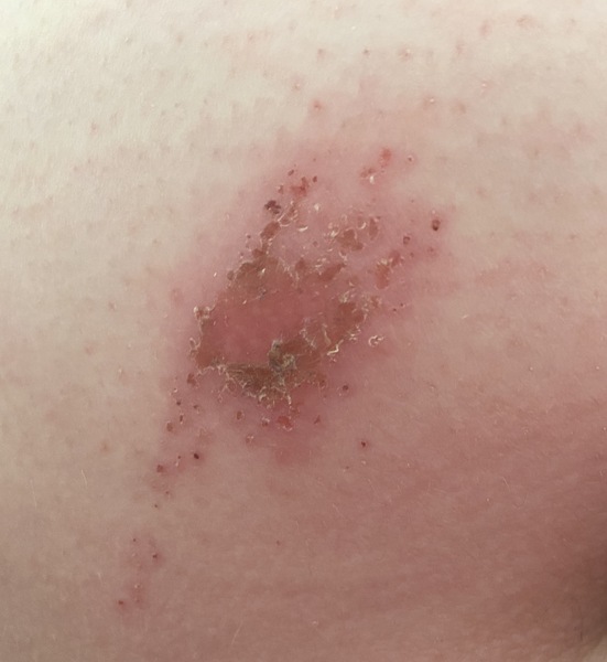 To ask if anyone knows why I could be getting these wounds?