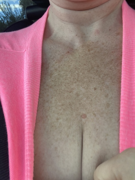 What is this on my chest?!