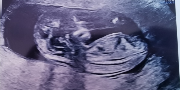 13 weeks any guesses