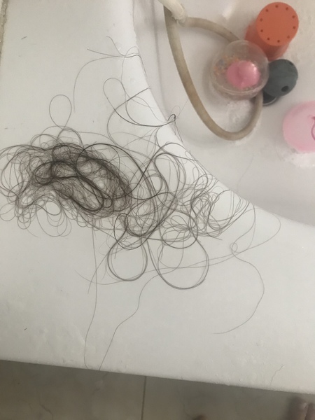 Covid lungs thread 18 weeks plus - thread 2