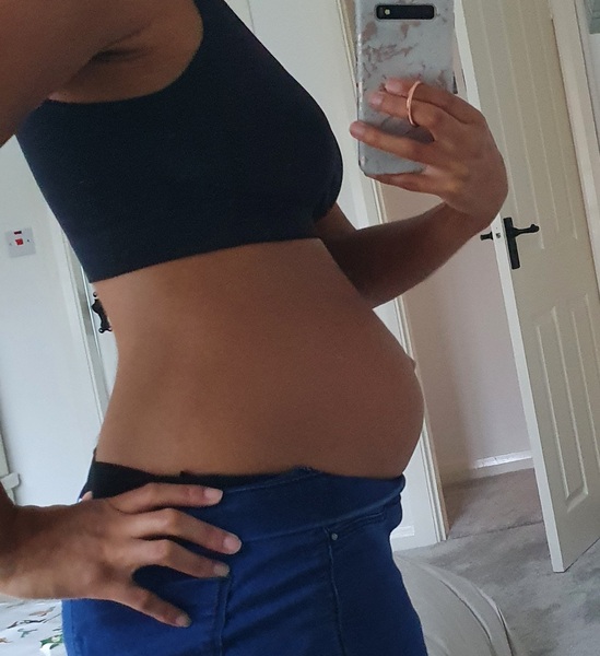 Pregnant After MMC - Thread 3