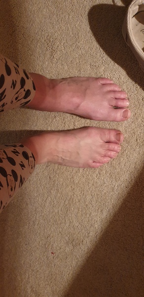 To ask if anybody is awake that can give an opinion on my ankle?