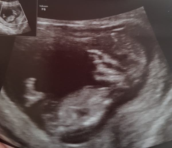 Gender guesses