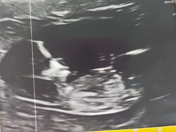 Any guesses?!