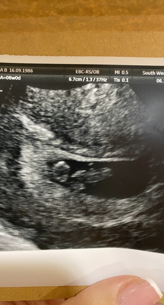 Tracking your cycle and possible BFP using RHR - part 3