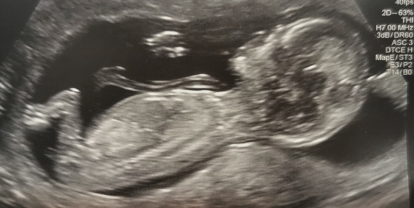 At Home Insemination - Buddies?