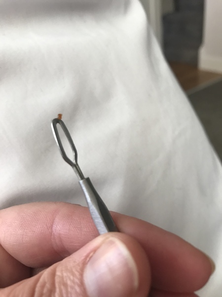 What is this in DC’s ear?